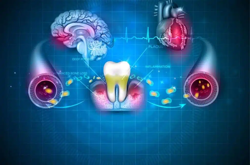Gum Disease And Dementia