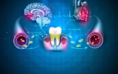 Gum Disease And Dementia