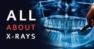 Why Do I Need Dental X-Rays?
